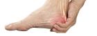Gout Specialist